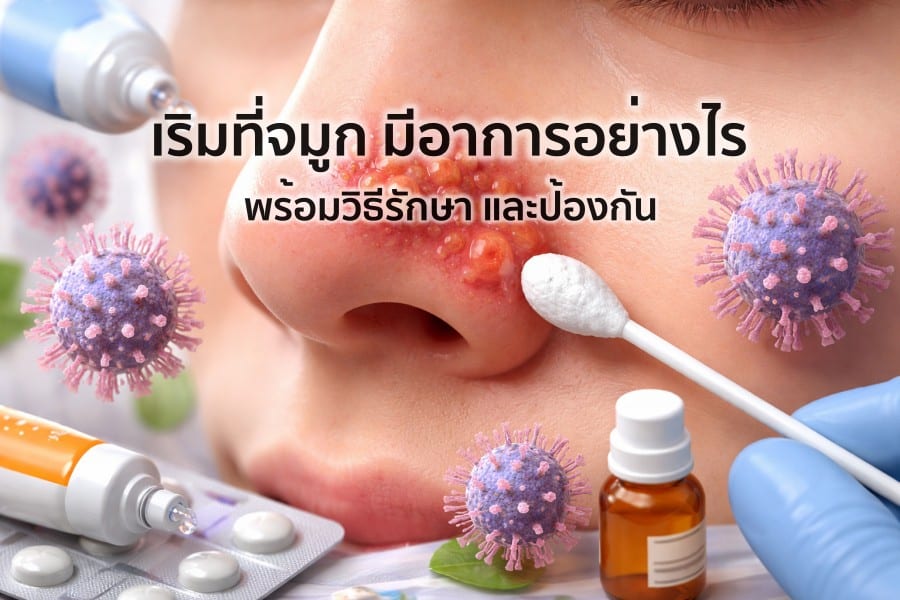 จากตุ่มใสสู่แผลเจ็บ เริมที่จมูก มีอาการอย่างไร พร้อมวิธีรักษา และป้องกัน